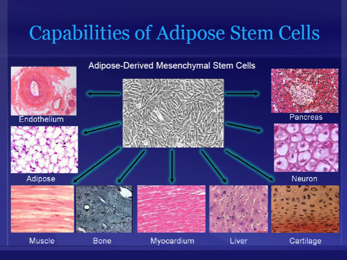 Adipose derived stem cell therapy